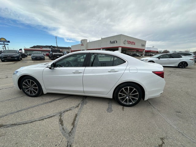 Acura TLX V6 SH-AWD with Advance Package 2017