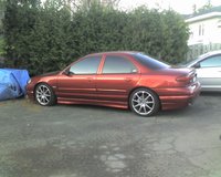 Contour SVT Contour SVT