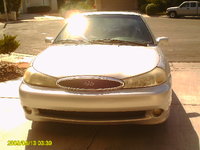 Contour SVT Contour SVT