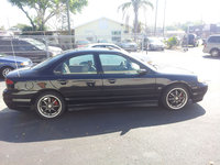 Contour SVT Contour SVT