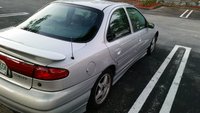 Contour SVT Contour SVT